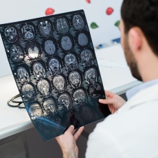 Doctor looking at ex rays of brain and skull